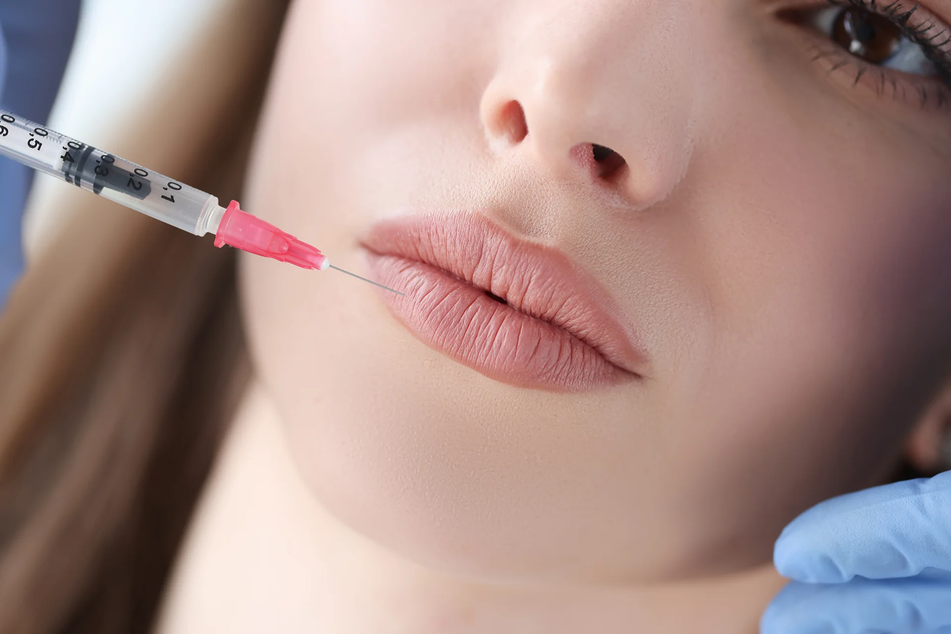 Do Lip Fillers Change Over Time? Aging Effects