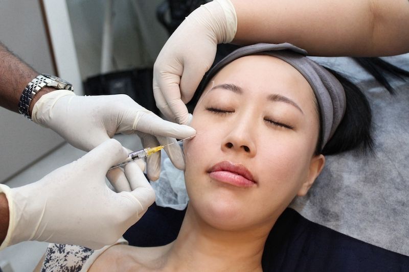 Tips to Maintain Results After Thread Lift Treatment
