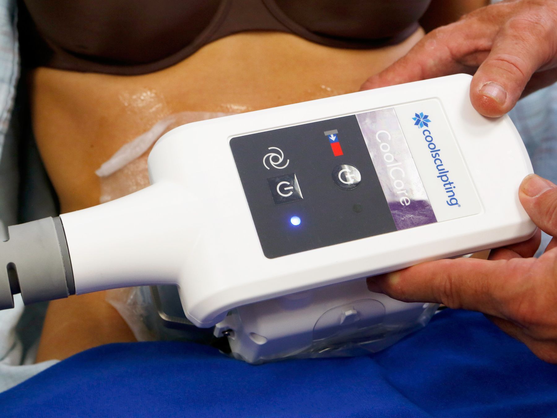 Is CoolSculpting Suitable for Both Men and Women?
