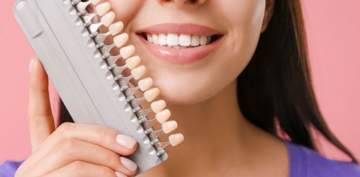 Are Dental Veneers Worth It for Minor Cosmetic Fixes?