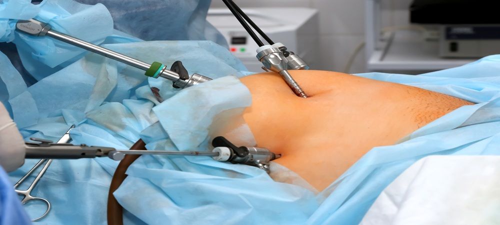 Can Bariatric Surgery Improve Mental Health and Confidence?