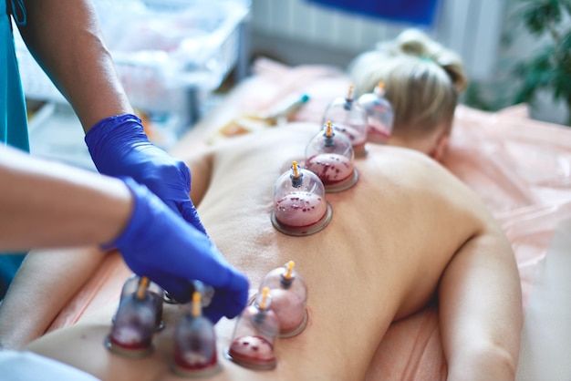 Understanding the Physiological Effects of Hijama Treatment