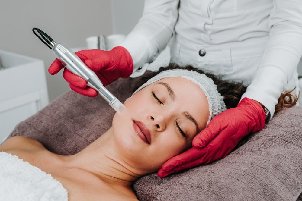 Morpheus8 for Hands: Skin Rejuvenation Tips