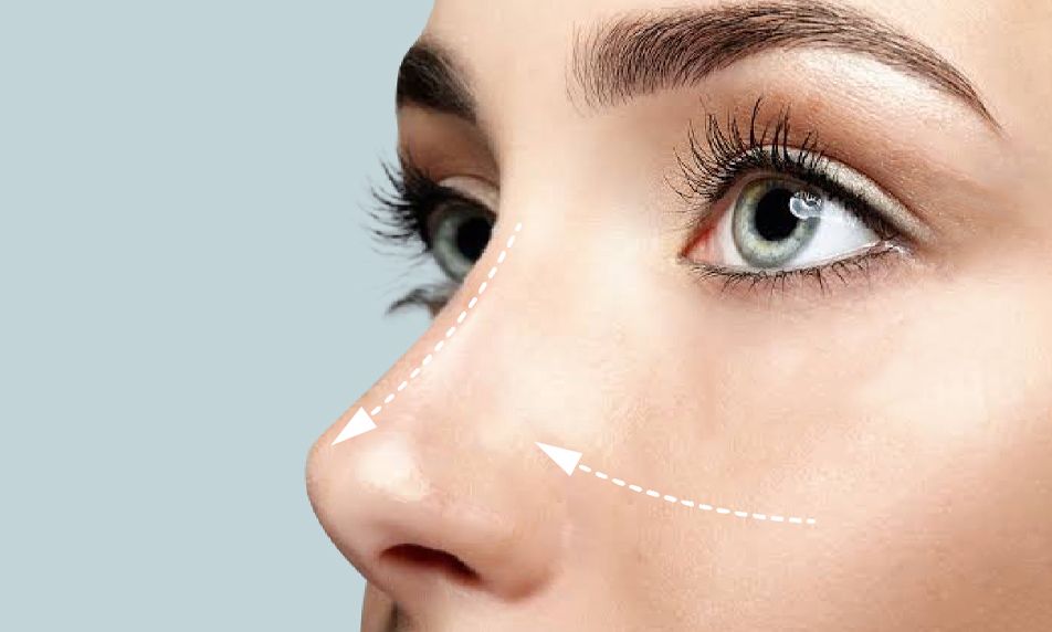 Rhinoplasty Price Transparency: Why It Matters