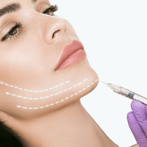 Facelift Surgery and Facial Fat Redistribution