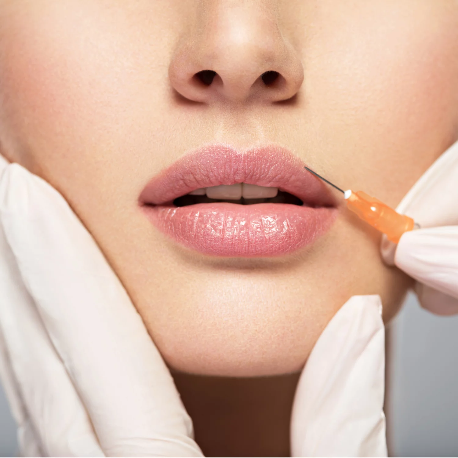 Natural Looking Results with Lip Fillers Injections Explained